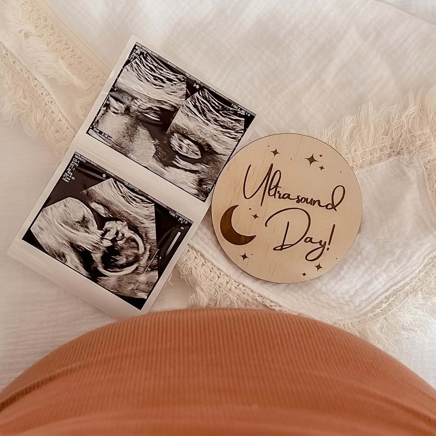 Pregnancy Milestone Disc Sets - Celestial